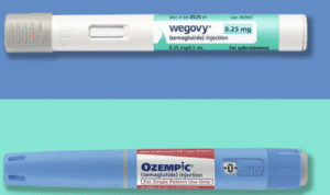 Treatment with Tirzepatide for Obesity