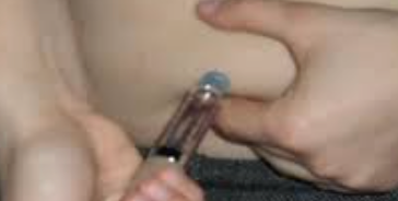 Cómo la TRT Puede Mejorar tu Composición Corporal y Fuerza