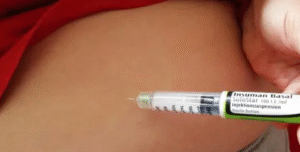 Terapia Hormonal Local vs. Sistémica: ¿Cuál es Mejor para Ti?