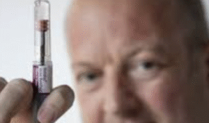 Tratamiento Hormonal para la Sequedad Vaginal y la Líbido Baja: Guía Detallada