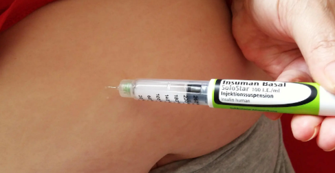 Tratamiento con Ácido Hialurónico: El Estándar de Excelencia Médica (Dr. G)