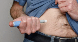 Borrar Cicatrices de Acné: Guía Completa de Tratamientos