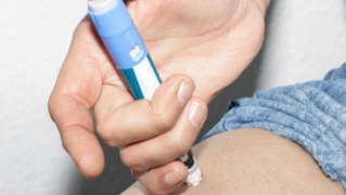 Lifting facial sin cirugía: Resultados y recuperación