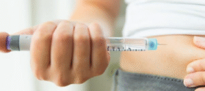 Tratamiento para la papada sin cirugía