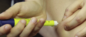 Ácido hialurónico vs. Bótox ¿Cuál es la diferencia?