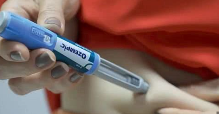 Armonización Íntima: Más Allá de la Estética, Conozca los Beneficios en la Salud y Placer Sexual