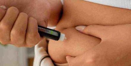 Toxina Botulínica (Bótox) para la Frente: El Estándar de Excelencia Médica (Dr. G)