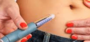 Eliminación de la Papada (Doble Mentón): Guía Detallada de Tratamientos Estéticos