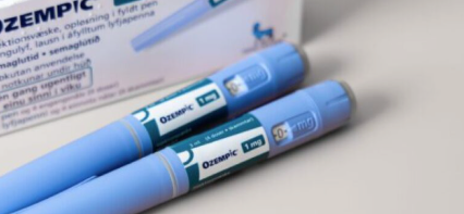 Eliminación de la Papada (Doble Mentón): Guía Detallada de Tratamientos Estéticos