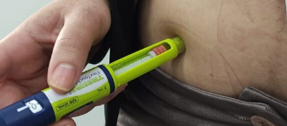 Eliminación de Tatuajes con Láser: Guía Detallada y Tecnología Avanzada