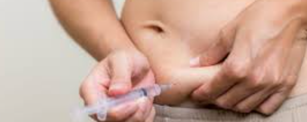 Eliminación de Varices con Láser: Tratamiento Endovenoso y Superficial