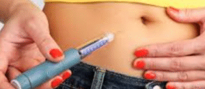 Inyecciones de Toxina Botulínica (Bótox): La Guía Definitiva