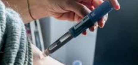 La Radiofrecuencia Facial: Qué es y Sus Beneficios