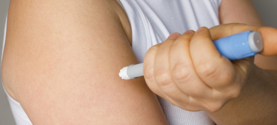 Medicina Estética para la Ojera Hundida (Surco de Lágrima): Guía Detallada