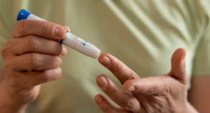 Mitos y Verdades sobre el Lifting Facial sin Cirugía