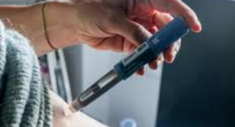 Peeling Químico: Tratamiento de Exfoliación Facial Detallado