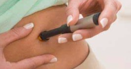 Radiofrecuencia Facial: Beneficios y Detalle del Tratamiento de Reafirmación