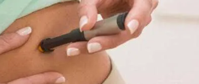 Toxina Botulínica (Bótox) para el Bruxismo: Guía Completa