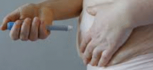 Tratamiento de Ojeras y Bolsas: Guía Detallada de Medicina Estética