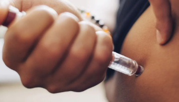 Rellenos con Ácido Hialurónico: Corrija Ojeras y Surcos en el Rostro Masculino