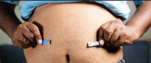 Tirzepatide: The Revolution in the Treatment of Obesity Tirzepatide: The Revolution in the Treatment of Obesity