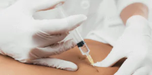 Tirzepatide for Weight Loss: Most Common Questions Answered