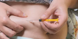 Tirzepatide for Weight Loss: Results and Medical Opinions