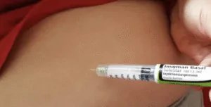 Terapia Hormonal Local vs. Sistémica: ¿Cuál es Mejor para Ti?