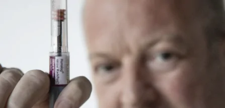 ¿Quién es Candidato para la Terapia de Reemplazo Hormonal