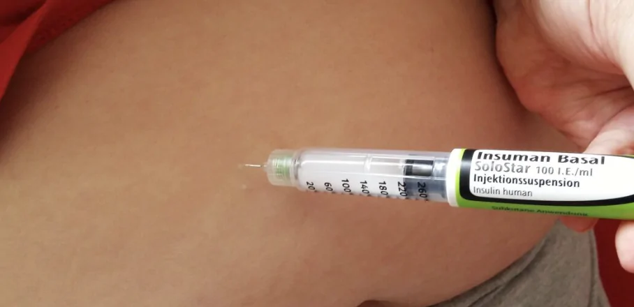 ¿Cómo se aplica la testosterona en gel?