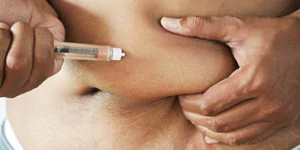 Toxina Botulínica (Bótox) para la Frente: El Estándar de Excelencia Médica (Dr. G)