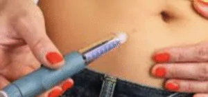 Eliminación de la Papada (Doble Mentón): Guía Detallada de Tratamientos Estéticos