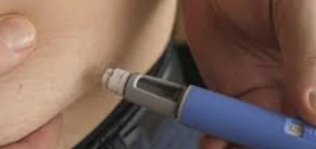 Láser, Ácido Hialurónico o Hilos: El Mejor Tratamiento para el Rejuvenecimiento Íntimo Femenino