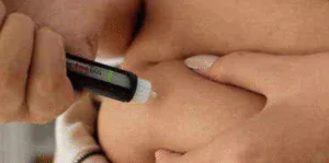 Tratamiento con Ácido Hialurónico para Pómulos: Definición y Efecto Lifting