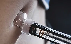 Tratamiento de Ojeras y Bolsas: Guía Detallada de Medicina Estética