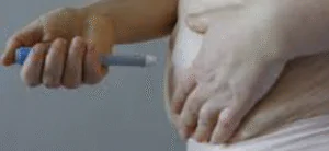 Tratamiento de Ojeras y Bolsas: Guía Detallada de Medicina Estética